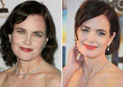 Elizabeth McGovern Plastic Surgery – Perfect Result for the Stage Star
